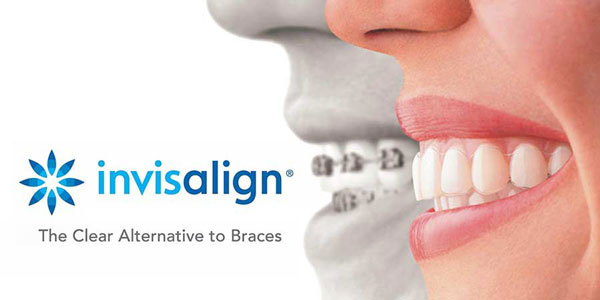 Invisalign logotypen